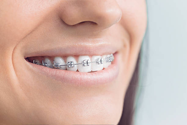Best Dental Inlays and Onlays  in Bayou Lourse, LA
